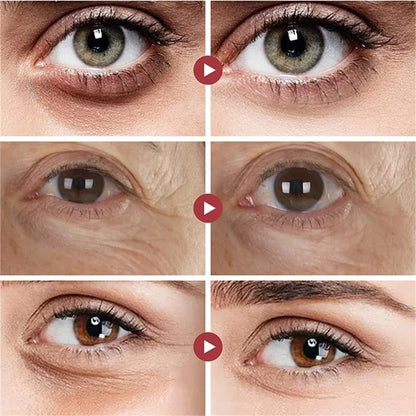 Máscara Hidratante de Aloe Vera para los Ojos - Antienvejecimiento, Elimina Arrugas y Ojeras